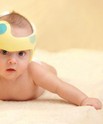 deformaciones-craneales